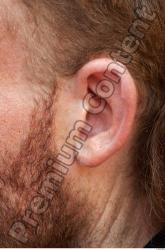 Ear Man White Underweight Bearded